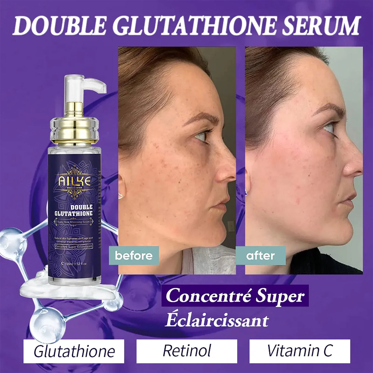 AILKE Glutathione Whitening Essence for Moisturized Even Skin Tone