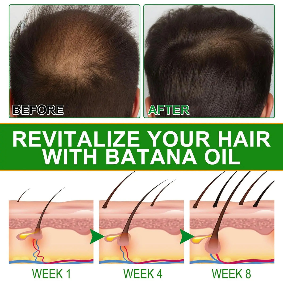 Amococo Batana Rosemary Nourishing Scalp Hair Oil Serum