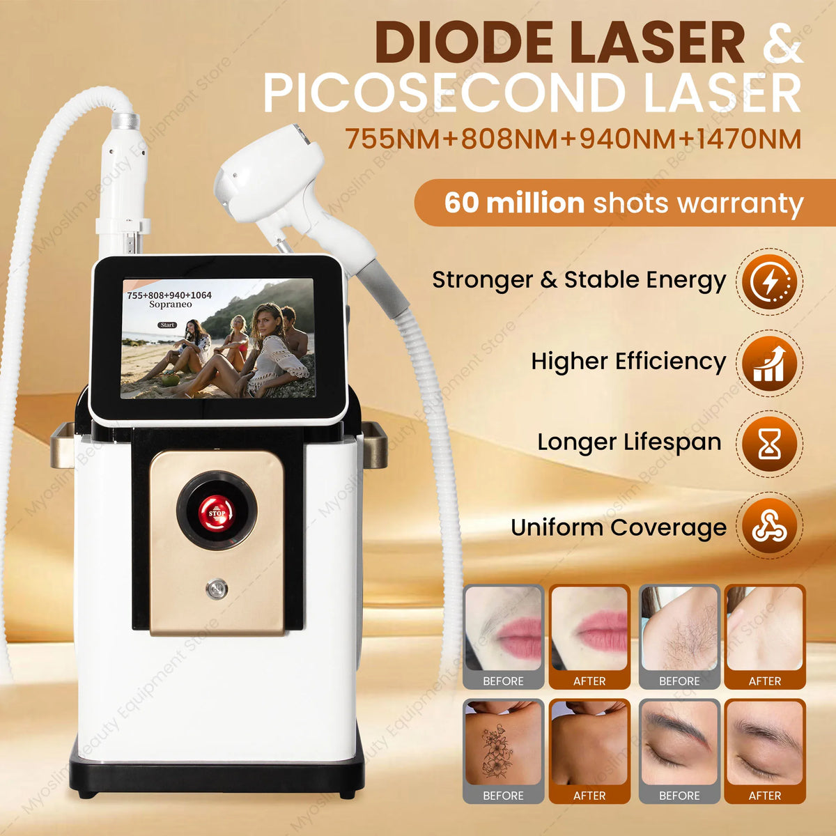 MYOSLIM Professional Diode Laser Hair Removal Machine With Cooling