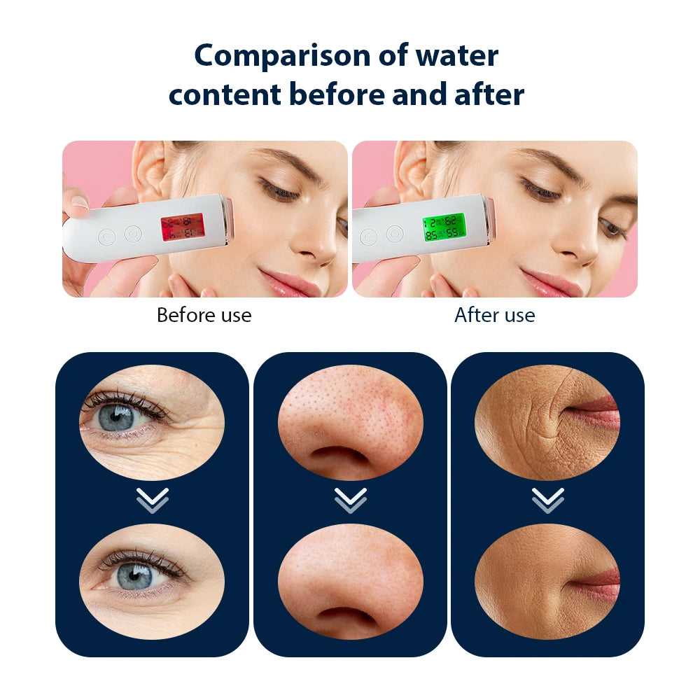 Iebilif LED Oxygen Bubble Facial Massager For Hydrating Skin