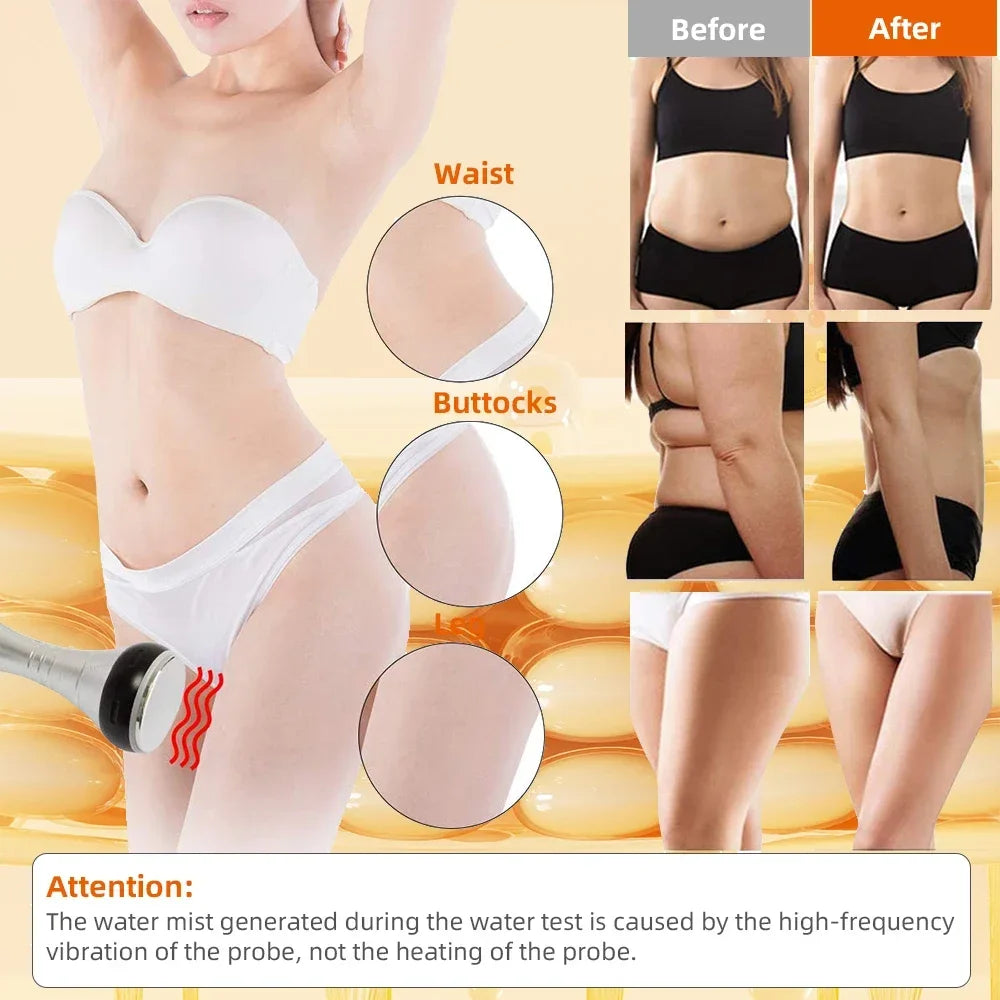Missheart Ultrasonic Cavitation Body Slimming Facial Massager