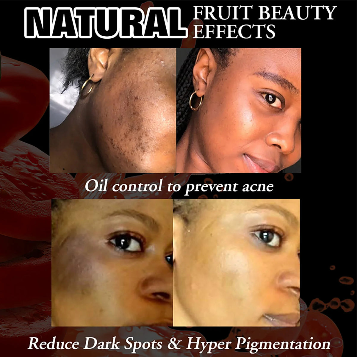 AILKE Natural Tomato Soap Bar For Cleansing And Hydrating Skin