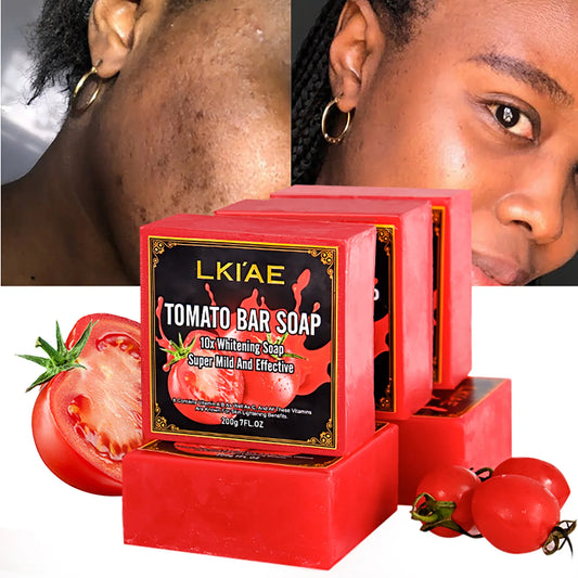 AILKE Natural Tomato Soap Bar For Cleansing And Hydrating Skin