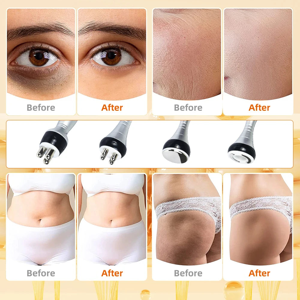 Missheart Ultrasonic Cavitation Body Slimming Facial Massager